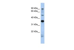 Aviva Systems Biology Corp MGC70924 Antibody - N-terminal region (ARP55933_P050)