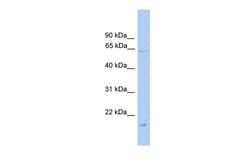 Aviva Systems Biology Corp GK Antibody - middle region (ARP55955_P050)