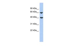 Aviva Systems Biology Corp APOBEC4 Antibody - N-terminal region (ARP55975_P050)