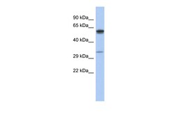 Aviva Systems Biology Corp ZDHHC24 Antibody - middle region (ARP55989_P050)