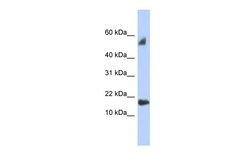 Aviva Systems Biology Corp FLJ35767 Antibody - middle region (ARP56005_P050)