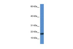 Aviva Systems Biology Corp Iscu Antibody - N-terminal region (ARP56014_P050)