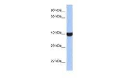 Aviva Systems Biology Corp TMED8 Antibody - middle region (ARP56016_P050)