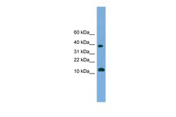 Aviva Systems Biology Corp MGAT4D Antibody - middle region (ARP56050_P050)