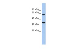 Aviva Systems Biology Corp FAM26A Antibody - C-terminal region (ARP56060_P050)