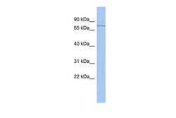 Aviva Systems Biology Corp PEX5 Antibody - N-terminal region (ARP56101_P050)