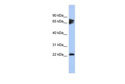 Aviva Systems Biology Corp PPP3R1 Antibody - N-terminal region (ARP56124_P050)