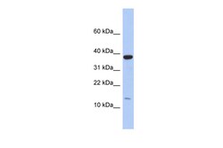 Aviva Systems Biology Corp RPL27 Antibody - middle region (ARP56132_P050)