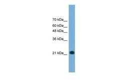 Aviva Systems Biology Corp MYL4 Antibody - N-terminal region (ARP56153_P050)