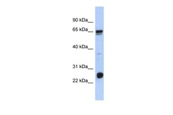 Aviva Systems Biology Corp C1orf103 Antibody - N-terminal region (ARP56173_P050)