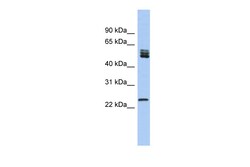 Aviva Systems Biology Corp SFRS7 Antibody - N-terminal region (ARP56231_P050)