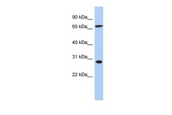 Aviva Systems Biology Corp SFRS7 Antibody - middle region (ARP56232_P050)