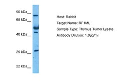 Aviva Systems Biology Corp MTRF1L Antibody - N-terminal region (ARP56319_P050)