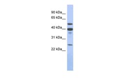 Aviva Systems Biology Corp MMP13 Antibody - middle region (ARP56350_P050)