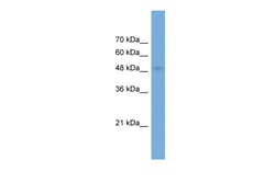 Aviva Systems Biology Corp NPTX2 Antibody - middle region (ARP56366_P050)