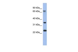 Aviva Systems Biology Corp TBC1D25 Antibody - N-terminal region (ARP56369_P050)