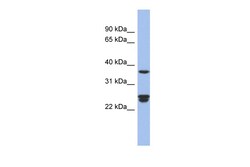 Aviva Systems Biology Corp OAZ2 Antibody - middle region (ARP56372_P050)