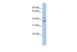 Aviva Systems Biology Corp SERPINB2 Antibody - middle region (ARP56375_P050)