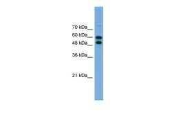 Aviva Systems Biology Corp PGM1 Antibody - middle region (ARP56383_P050)