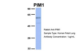 Aviva Systems Biology Corp PIM1 Antibody - N-terminal region (ARP56389_P050)