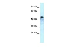 Aviva Systems Biology Corp Ppp1r7 Antibody - C-terminal region (ARP56408_P050)