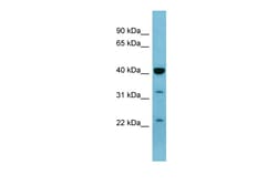 Aviva Systems Biology Corp MAPK3 Antibody - middle region (ARP56431_P050)
