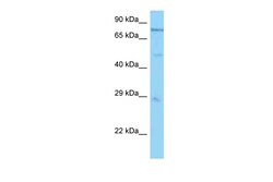 Aviva Systems Biology Corp Psmc1 Antibody - N-terminal region (ARP56475_P050)