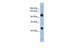 Aviva Systems Biology Corp PSMD1 Antibody - N-terminal region (ARP56477_P050)