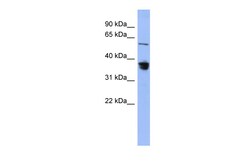 Aviva Systems Biology Corp RAD23B Antibody - middle region (ARP56506_P050)