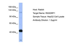 Aviva Systems Biology Corp RASGRF1 Antibody - N-terminal region (ARP56516_P050)