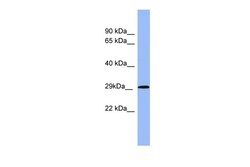 Aviva Systems Biology Corp RAB5A Antibody - middle region (ARP56562_P050)