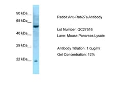 Aviva Systems Biology Corp Rab27a Antibody - middle region (ARP56564_P050)