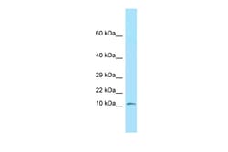 Aviva Systems Biology Corp Ndufs6 Antibody - N-terminal region (ARP56580_P050)