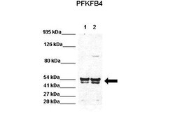 Aviva Systems Biology Corp PFKFB4 Antibody - N-terminal region (ARP56584_P050)