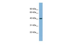Aviva Systems Biology Corp SERPINI1 Antibody - middle region (ARP56616_P050)