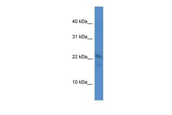 Aviva Systems Biology Corp Omp Antibody - C-terminal region (ARP56669_P050)