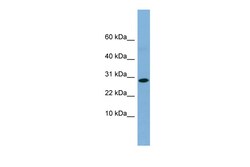 Aviva Systems Biology Corp RPE Antibody - middle region (ARP56725_P050)