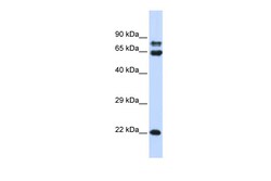 Aviva Systems Biology Corp PPP2R1A Antibody - N-terminal region (ARP56741_P050)