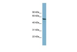 Aviva Systems Biology Corp PGM3 Antibody - middle region (ARP56756_P050)
