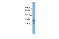 Aviva Systems Biology Corp CUTC Antibody - middle region (ARP56790_P050)