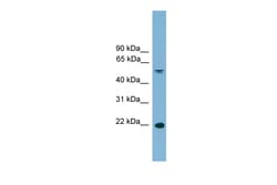 Aviva Systems Biology Corp HDGFL3 Antibody - middle region (ARP56825_P050)