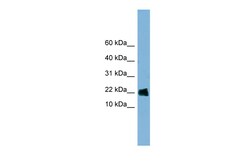 Aviva Systems Biology Corp GOLGA7 Antibody - middle region (ARP56837_P050)