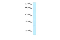 Aviva Systems Biology Corp Ak3 Antibody - C-terminal region (ARP56873_P050)