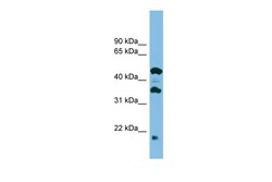 Aviva Systems Biology Corp HIKESHI Antibody - middle region (ARP56903_P050)