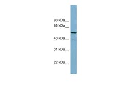 Aviva Systems Biology Corp CDK5RAP1 Antibody - N-terminal region (ARP56906_P050)
