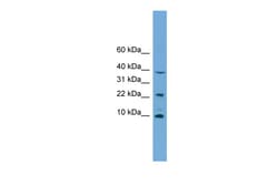Aviva Systems Biology Corp CHCHD8 Antibody - middle region (ARP56948_P050)