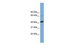 Aviva Systems Biology Corp KCTD9 Antibody - middle region (ARP56987_P050)