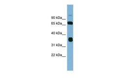 Aviva Systems Biology Corp OSGEP Antibody - N-terminal region (ARP57037_P050)