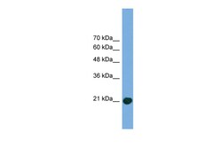 Aviva Systems Biology Corp COMMD8 Antibody - middle region (ARP57050_P050)