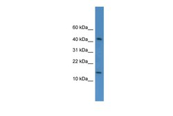 Aviva Systems Biology Corp FLJ10490 Antibody - middle region (ARP57114_P050)